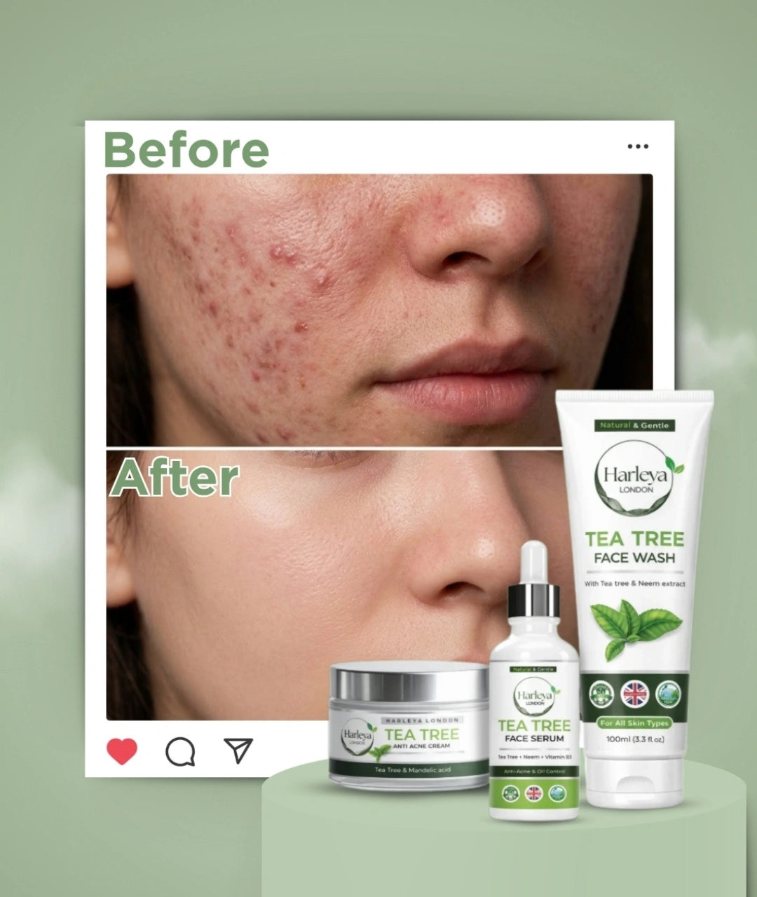 Tea Tree Bundle