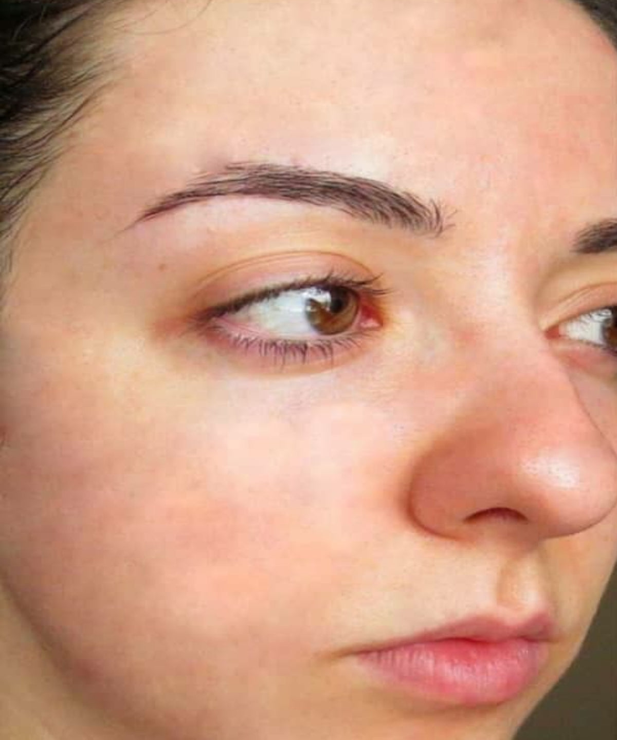 Hyper Pigmentation To Clear Skin