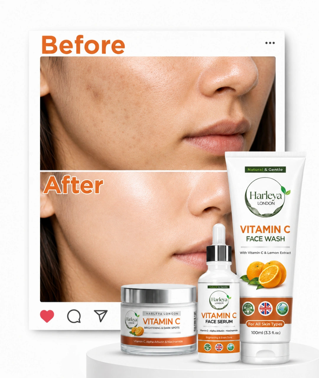 Vitamin C Bundle