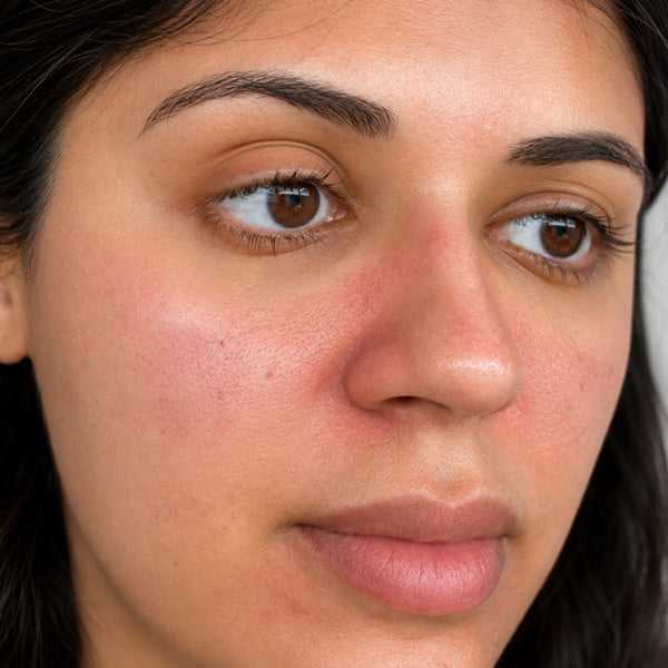 Barrier Repair skincare