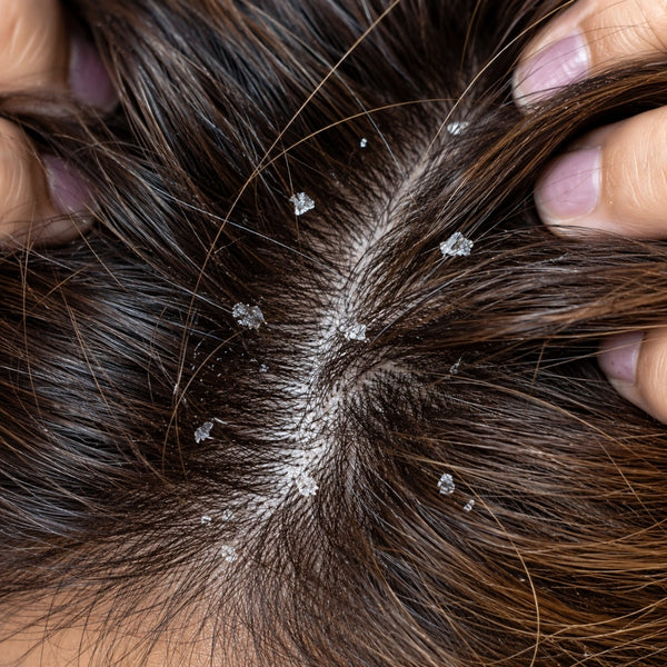 Dandruff haircare